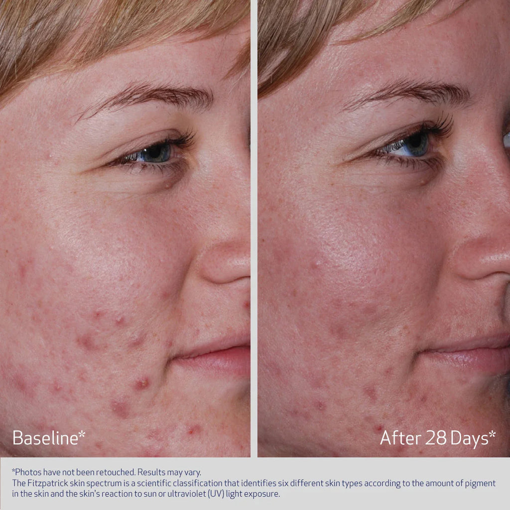 Clenziderm MD System