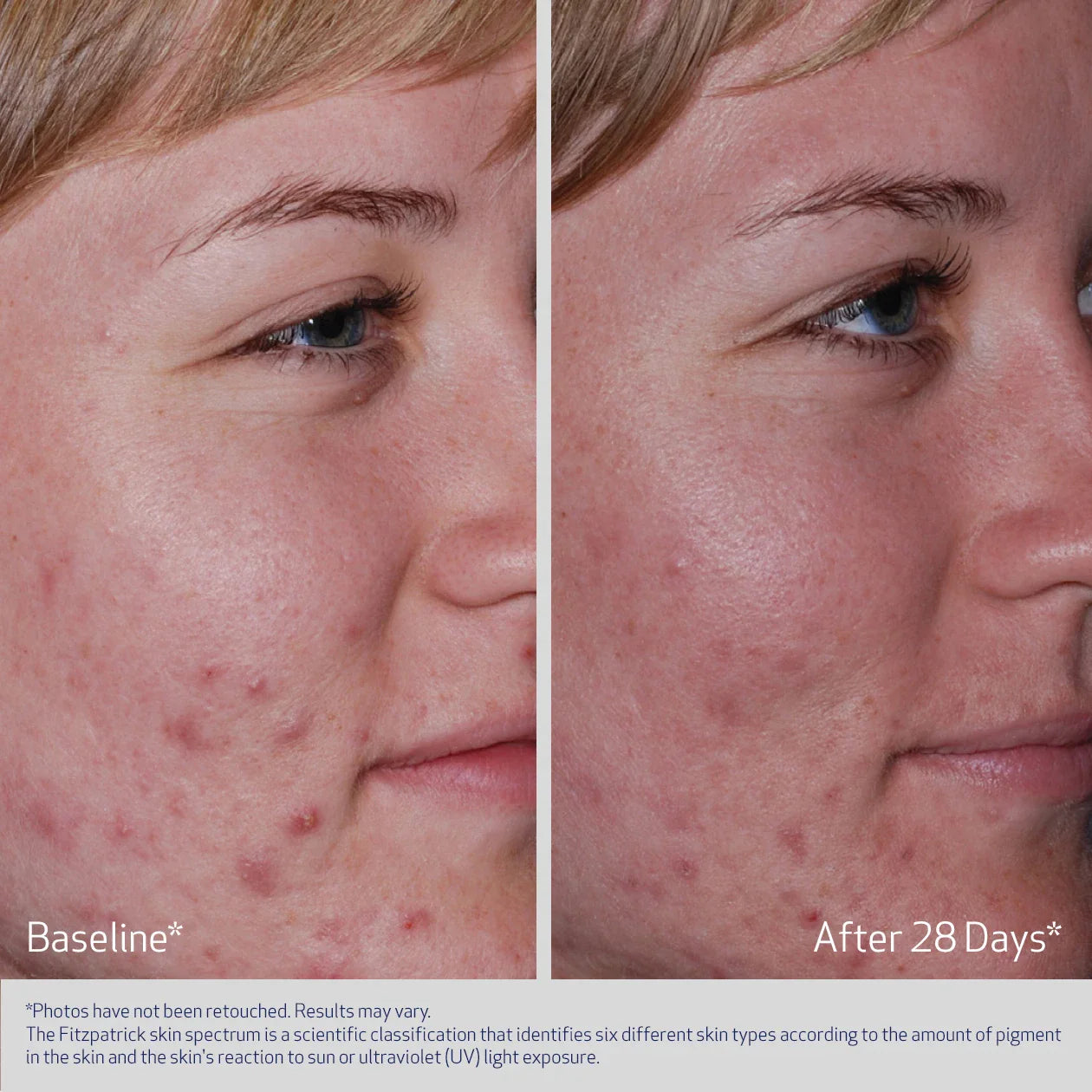 Clenziderm MD System