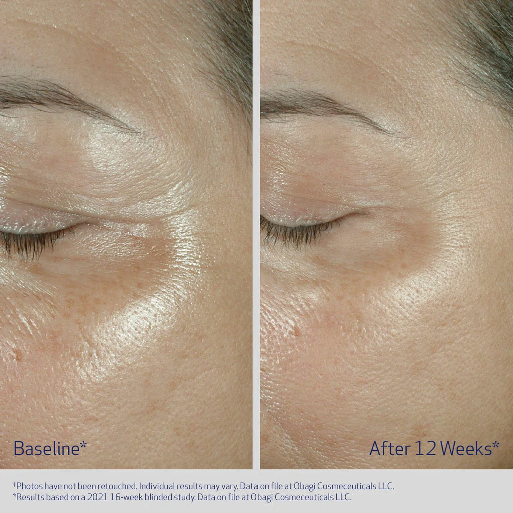 Elastiderm Eye Cream