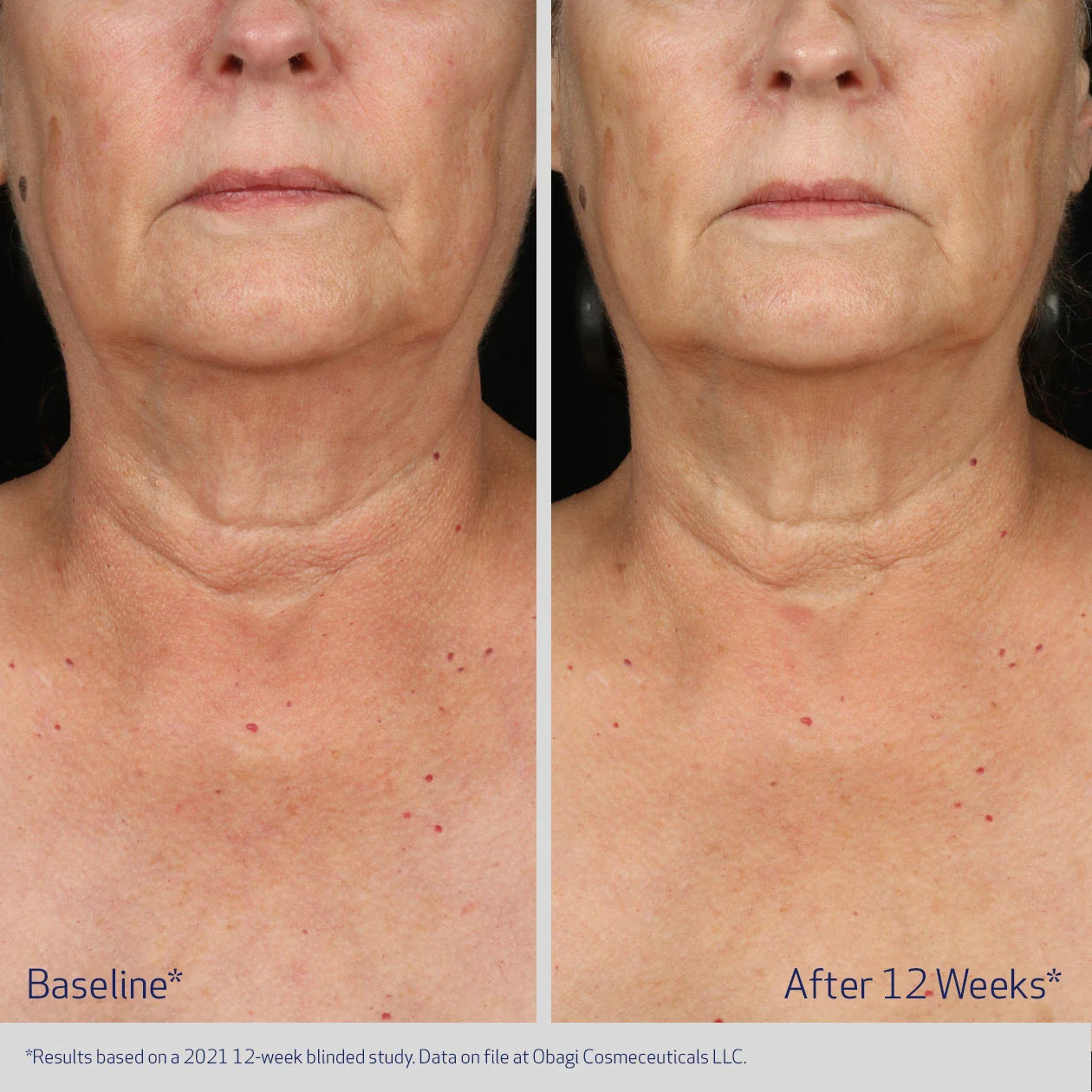 Elastiderm Neck and Decollete Concentrate