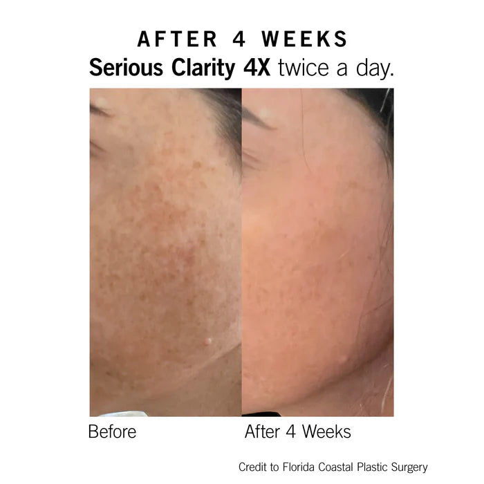 Serious Clarity 30ml