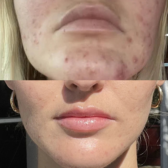 Microfoliant Cleanser
